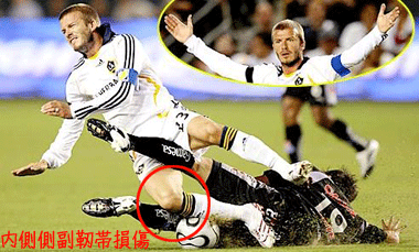 David-Beckham-内側側副靭帯.gif